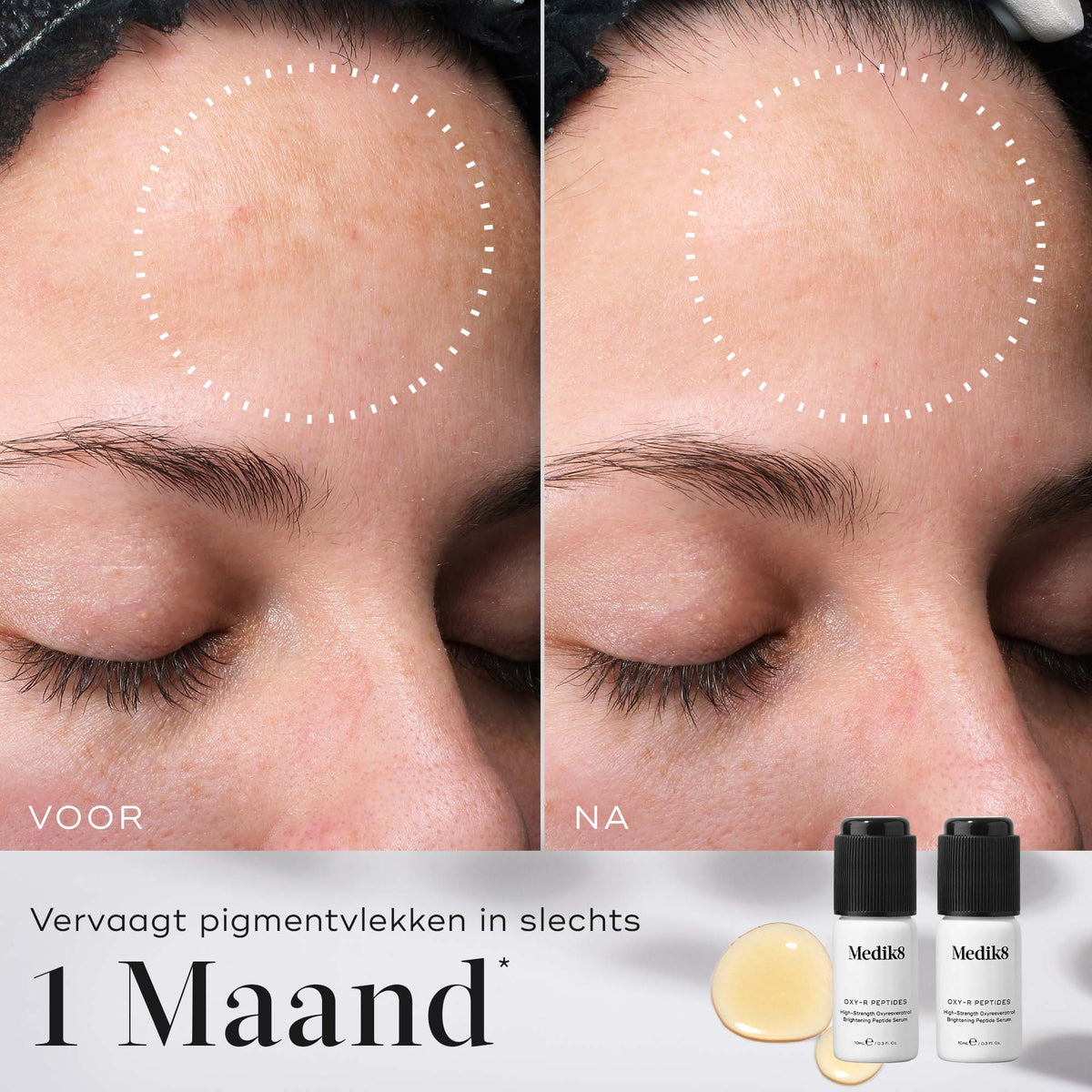 Medik8 Oxy-R Peptides 2x 10ml voor en na resultaat