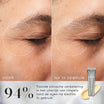 Medik8 Crystal Retinal Ceramide Eye 6 15ml voor en na resultaat