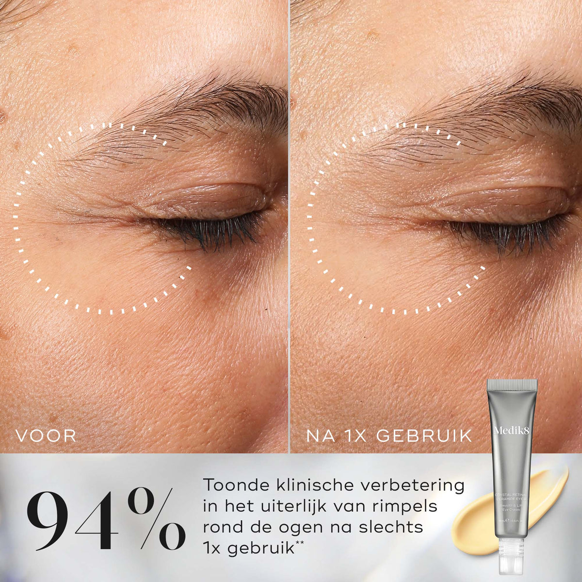 Medik8 Crystal Retinal Ceramide Eye 6 15ml voor en na resultaat
