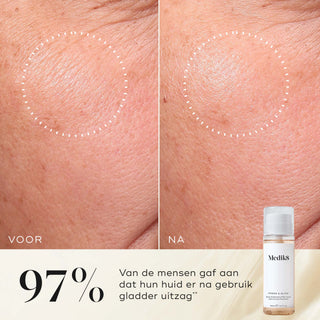 Medik8 Press & Glow Refill 200ml voor en na resultaat