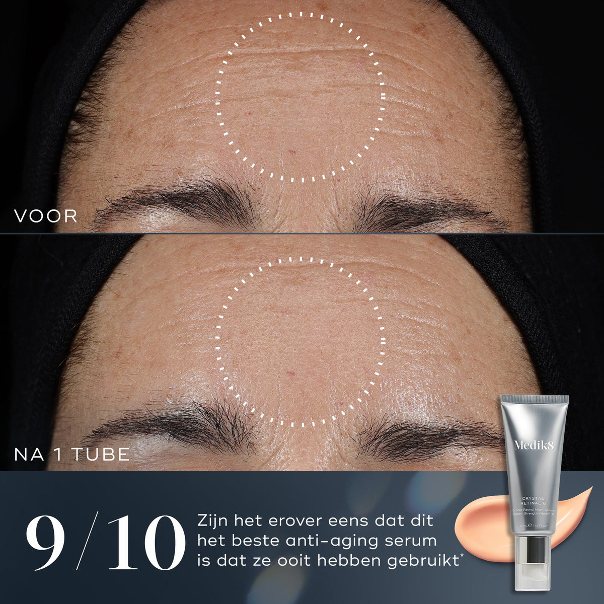 Medik8 Crystal Retinal 20 30ml voor en na resultaat twee