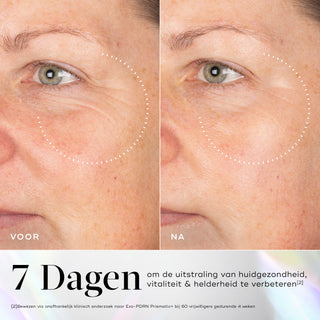 Medik8 Exo-PDRN Prismatic+ 30ml voor en na resultaat twee