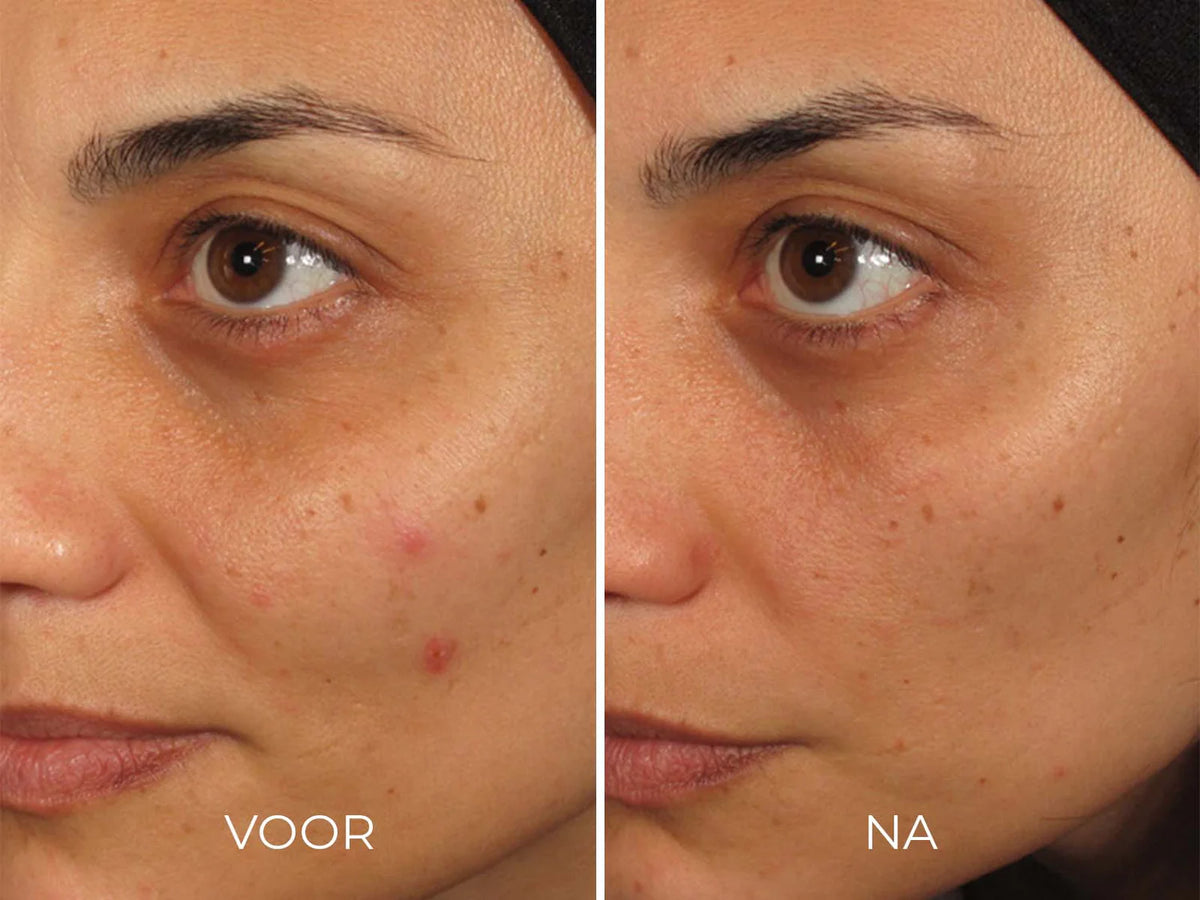 ILUMA - Intense Facial Illuminator 30ml | Image Skincare