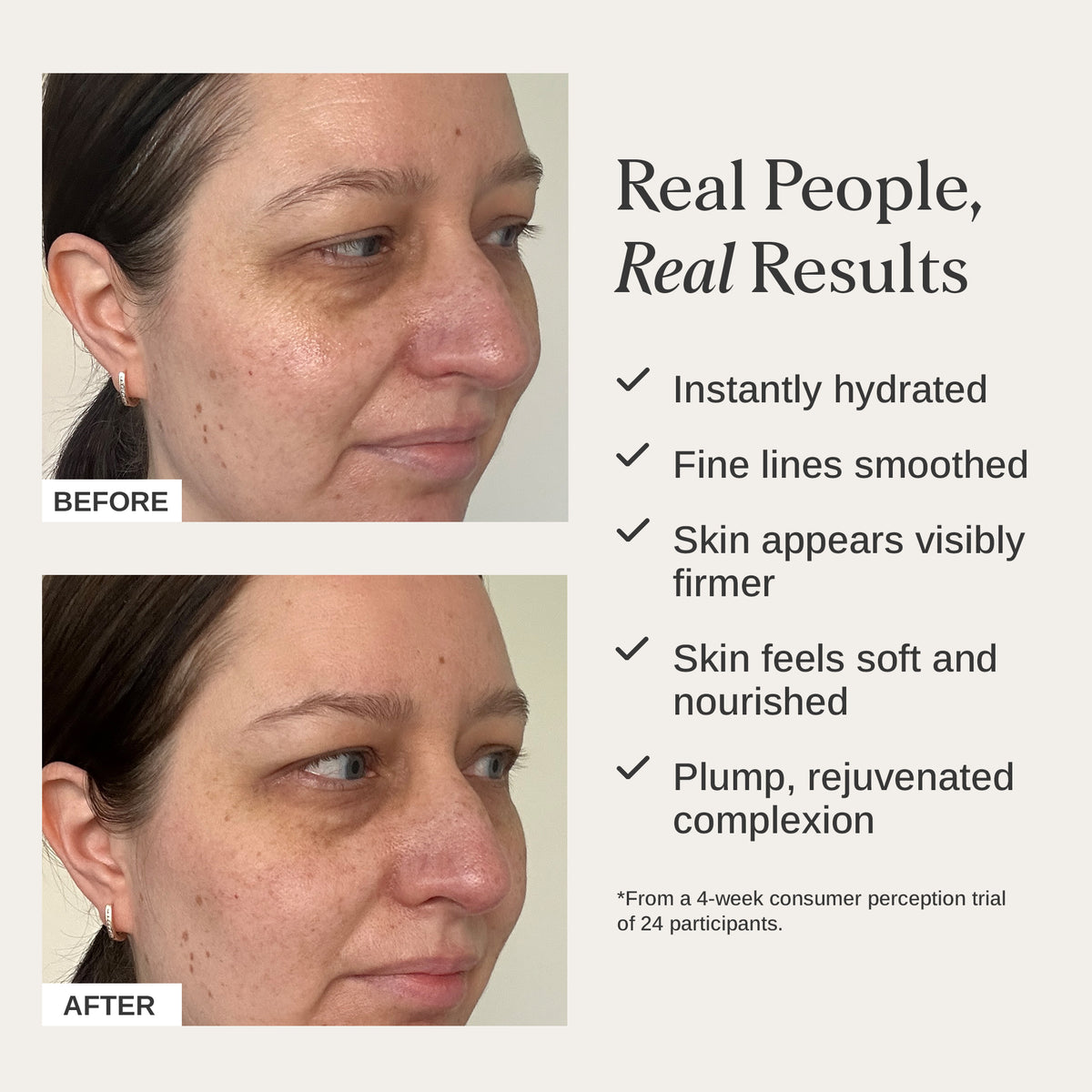 Alpha-H Firming Collagen Repair Cream results