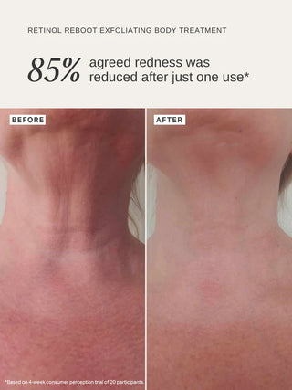 Retinol Reboot Exfoliating Body Treatment 120ml | Alpha-H
