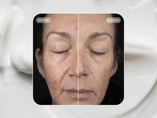 Image Skincare VOL.U.LIFT - 4D Skin Rebound Complex 57gr resultaat