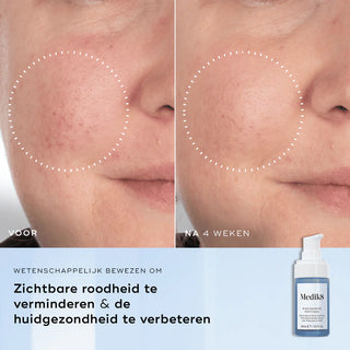 Niacinamide peptides 30ml | Medik8