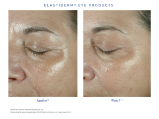 Obagi Elastiderm Eye Cream sfeer