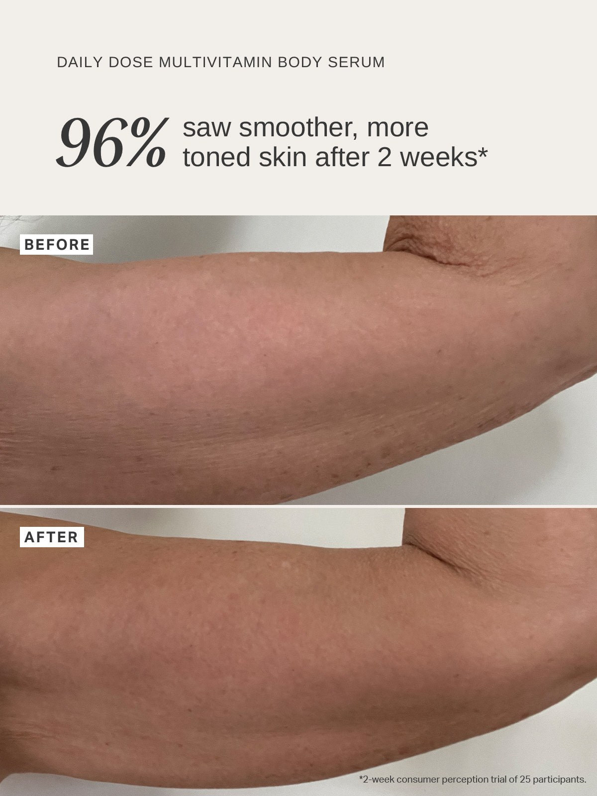 Alpha-H Daily Dose Multivitamin Body Serum voor en na arm