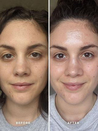 Alpha-H Liquid Gold Exfoliating Treatment voor en na resultaat twee