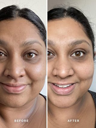 Alpha-H Liquid Gold Exfoliating Treatment voor en na resultaat vier