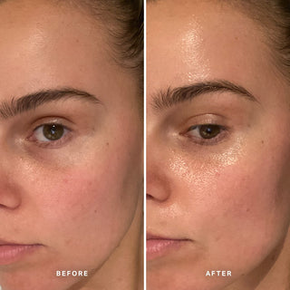 Alpha-H Midnight Reboot Serum voor en na resultaat drie