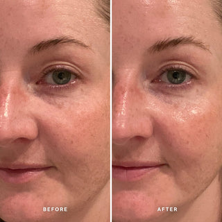 Alpha-H Midnight Reboot Serum voor en na resultaat twee