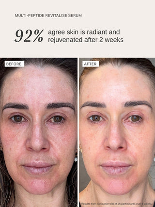 Alpha-H Multi-Peptide Revitalise Serum voor en na resultaat twee