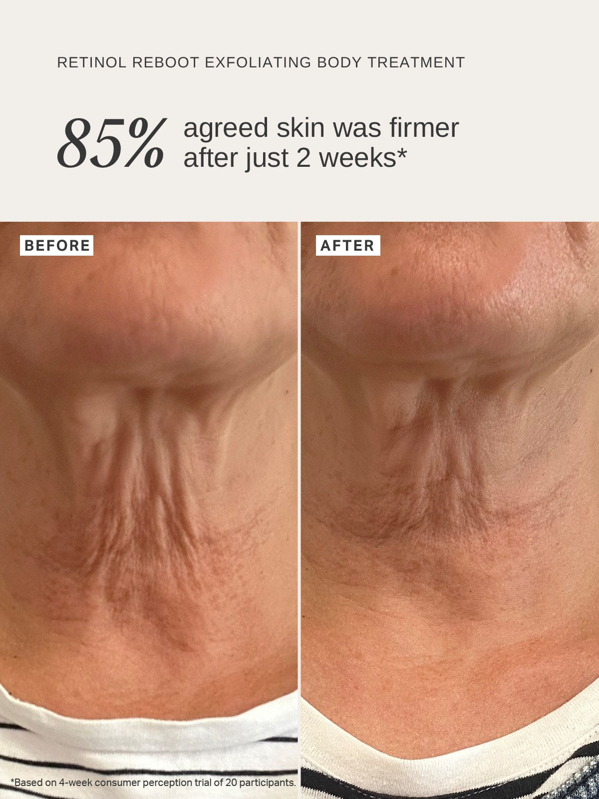 Alpha-H Retinol Reboot Exfoliating Body Treatment voor en na stevigere huid