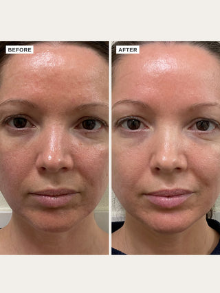 Alpha-H Vitamin B Serum voor en na resultaat drie