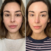 Alpha-H Vitamin C Serum voor en na resultaat twee