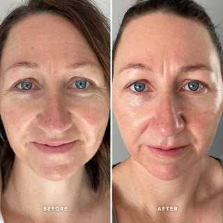 Alpha-H Vitamin E Serum voor en na resultaat