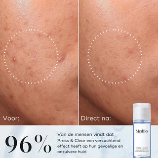 Press & Clear 150ml | Medik8