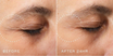 Medik8 Crystal Retinal Ceramide Eye 6 15ml effect