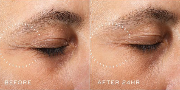 Medik8 Crystal Retinal Ceramide Eye 6 15ml effect